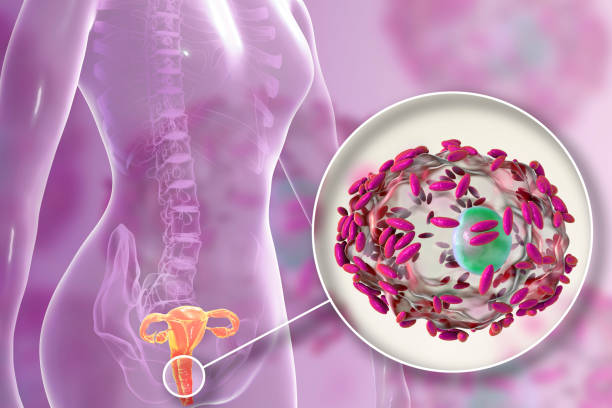 mycose, candidose, vaginose, infection vaginale