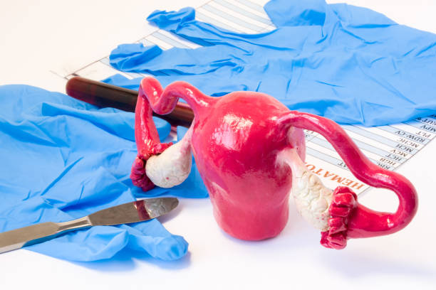 chirurgie de la femme, chirurgien gynecologue