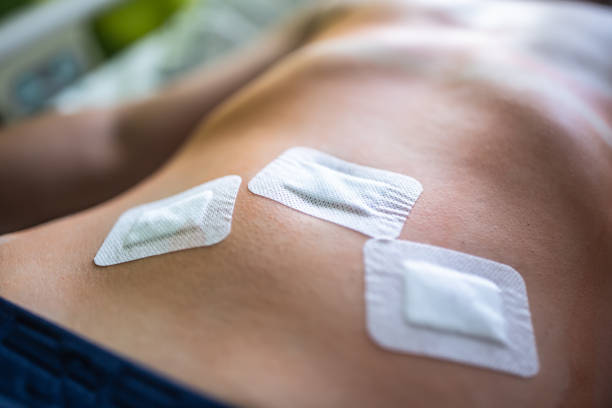 cicatrice, coelioscopie, chirurgie femme