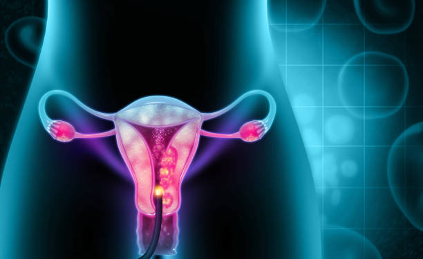 pathologie de la femme et de l'utérus