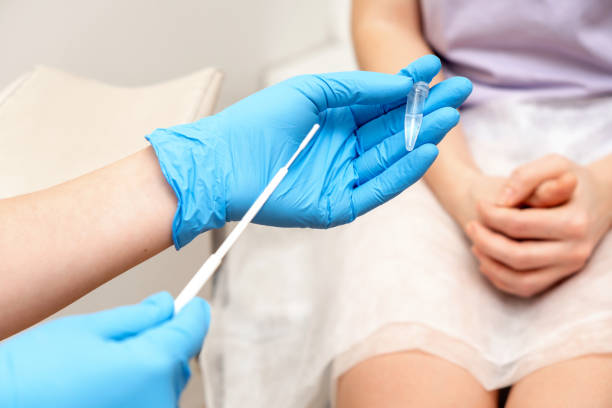 prelèvement vaginal, infection sexuellement transmissible femme