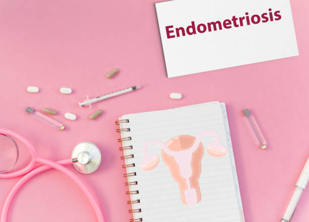 endometriose
