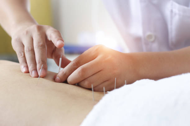 acupuncture femme